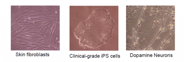 피부세포, 유도만능 줄기세포, 도파민 뉴런의 사진.